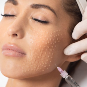 Mezoterapija un biorevitalizācija estētiskajā kosmetoloģijā 24TIP, LĀPPOS Nr. TIP2026/154